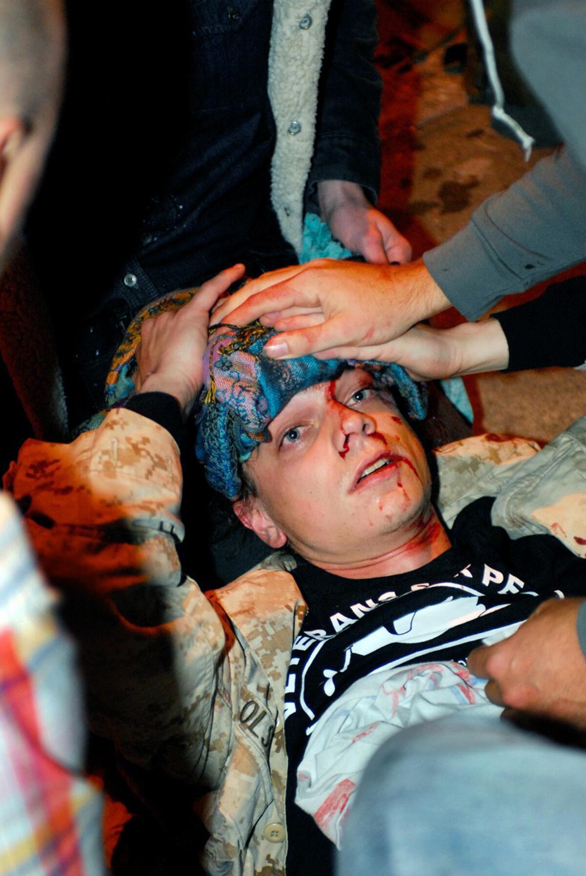 Iraq war veteran Scott Olsen lies on the ground bleeding from a head wound after being struck by a projectile during an Occupy Wall Street protest in Oakland, Calif., on Oct. 25, 2011.