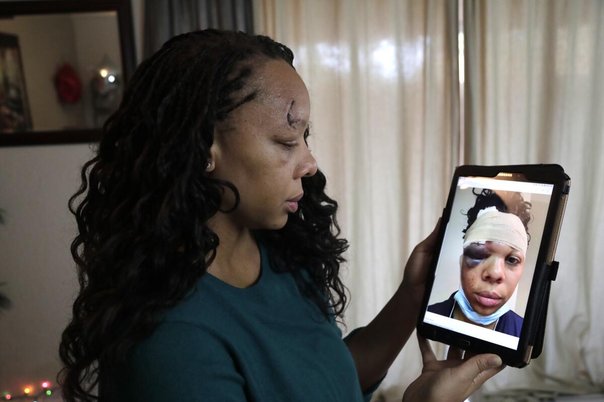 LaToya Ratlieff with a photo of herself after she was hit by a police officer's rubber bullet.