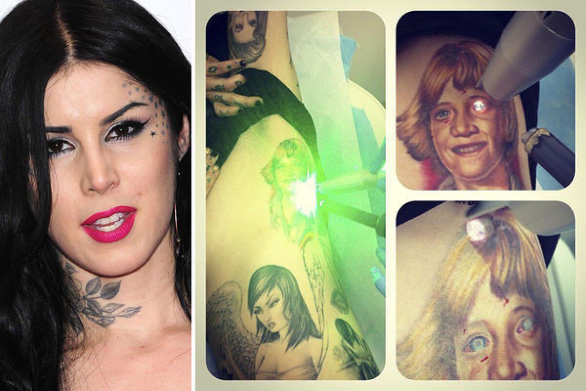 Kat Von D, left, posted an Instagram composite shot, right, on Friday after starting laser removal of a tattoo of young Jesse James, her ex-fiance.