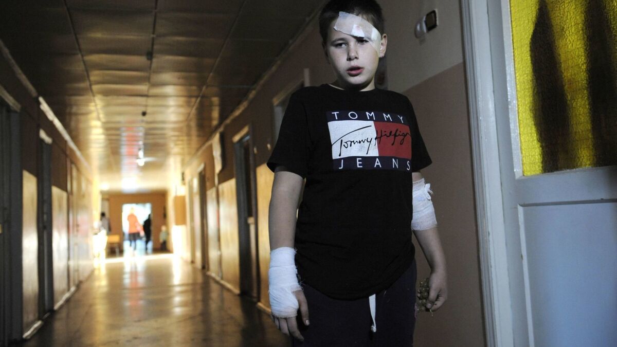 Dmitriy Vadimovich, 10, stands in a hospital corridor in the town of Horlivka, north of the rebel area's de facto capital, Donetsk, after he was injured by a landmine Sunday.