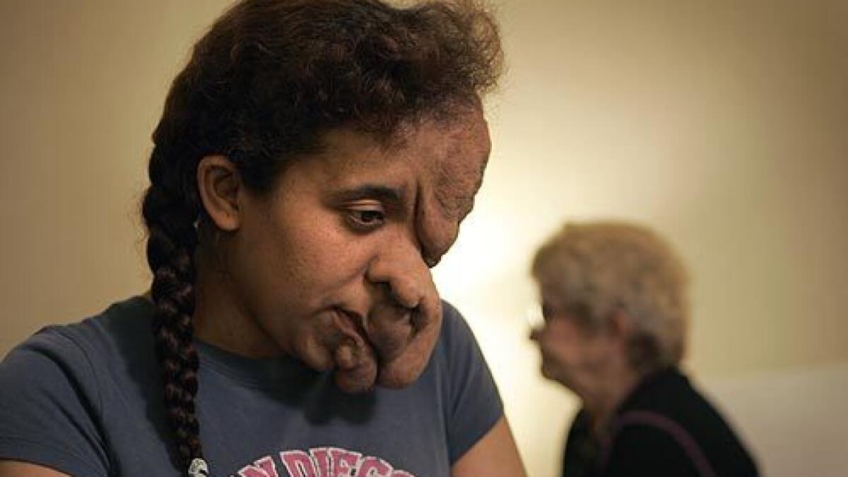 Woman: Fix-A-Flat 'doctor' disfigured my face – Orange County Register