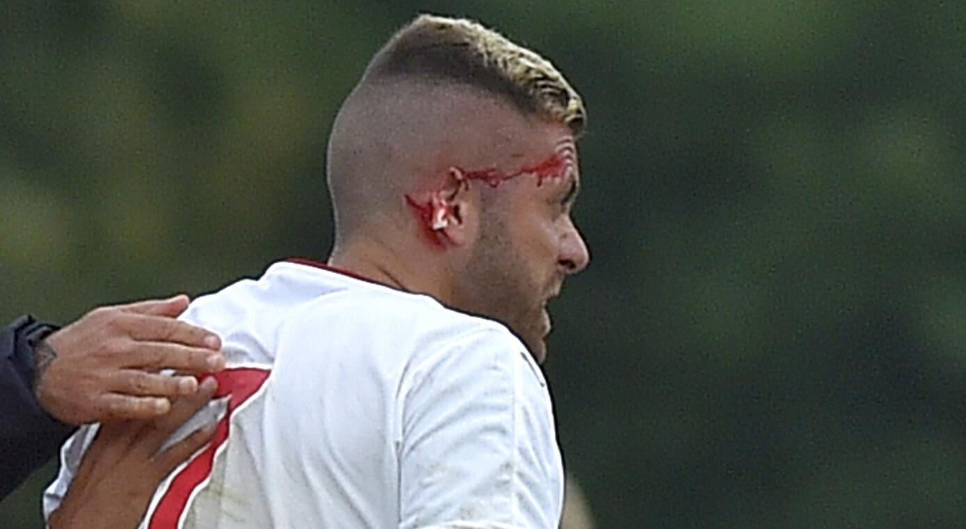 Futbolista pierde parte de la oreja derecha