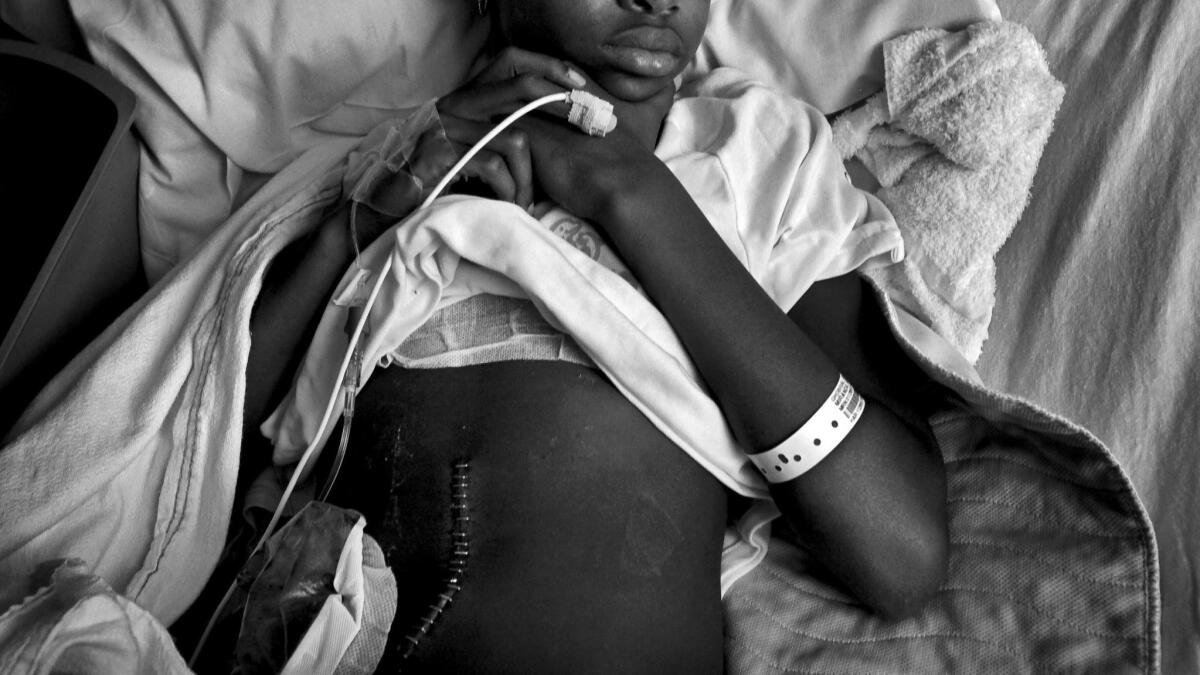 This 10-year-old girl was shot by a gang member while playing basketball outside her home in Compton in 2010. Between 2006 and 2014, 11.3 out of every 100,000 American children were treated for gun-related injuries in hospital emergency rooms.