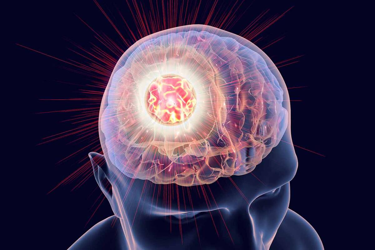 Conceptual image for brain cancer treatment