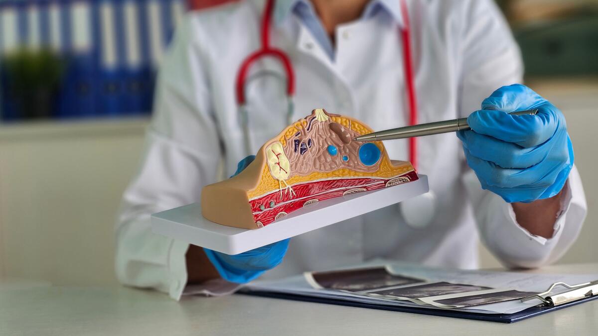Doctor explains breast anatomy using anatomical model.