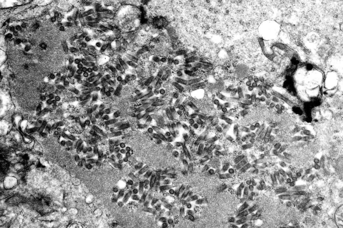 A microscope image shows rabies virions, dark and bullet-shaped, within an infected tissue sample. 