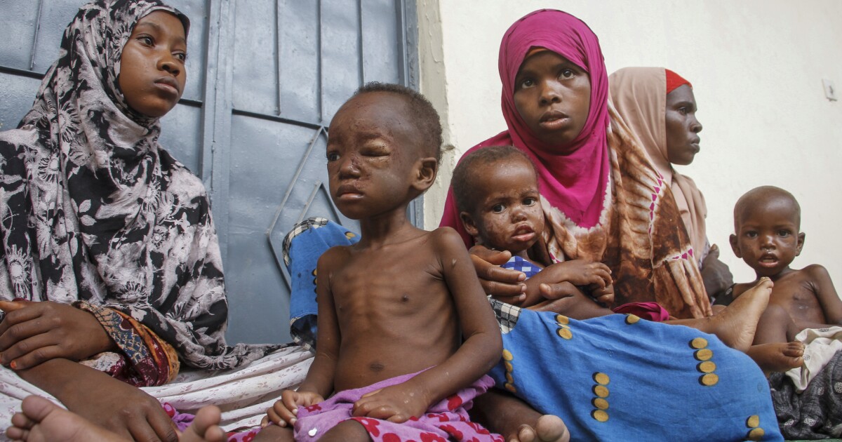 Famine threatens wide swaths of world, now worsened by Ukraine war Famine threatens wide swaths of world, now worsened by Ukraine war