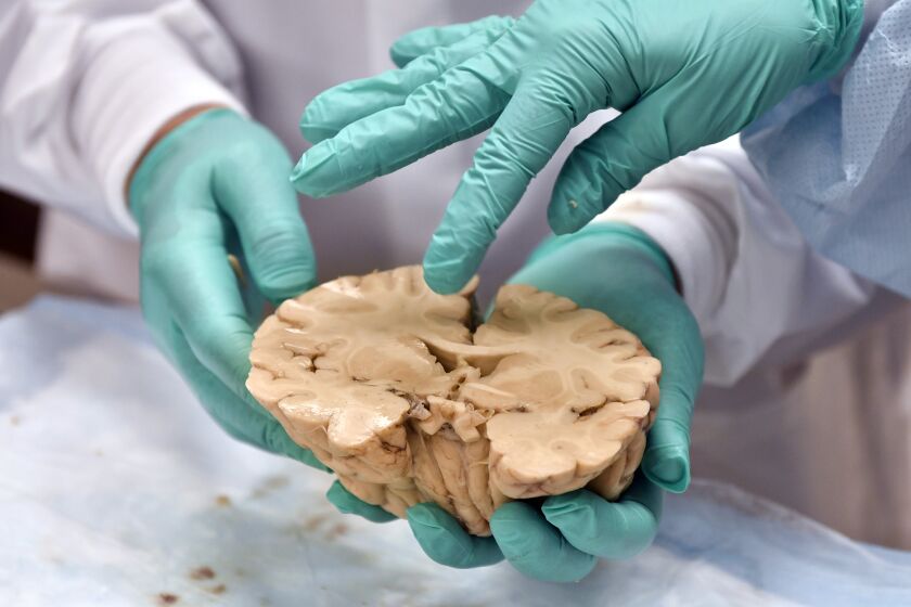 BOSTON, 8/28/2019 - Dr. Victor Alvarez, Neuropathologist, and Dr. Ann McKee, chief of neuropathology of VA's Boston Healthcare System examine damaged areas within the brain of a football player suspected to have suffered from CTE in the VA's brain lab. McKee said the brain, that of an unidentified football player, showed significant damage, but much work remained before a determination could be made regarding CTE. Josh Reynolds/ For the Times