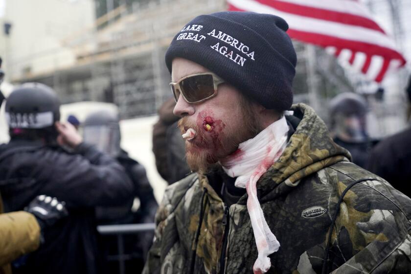 FILE - Joshua Matthew Black, a supporter of then-President Donald Trump, is shown injured after shot by a police crowd-control munition during clashes with police at the U.S. Capitol, Jan. 6, 2021, in Washington. The Alabama man has been sentenced to nearly two years in prison for storming the U.S. Capitol and invading the Senate floor with a knife on his hip and a gaping wound on his face. (AP Photo/Julio Cortez, File)
