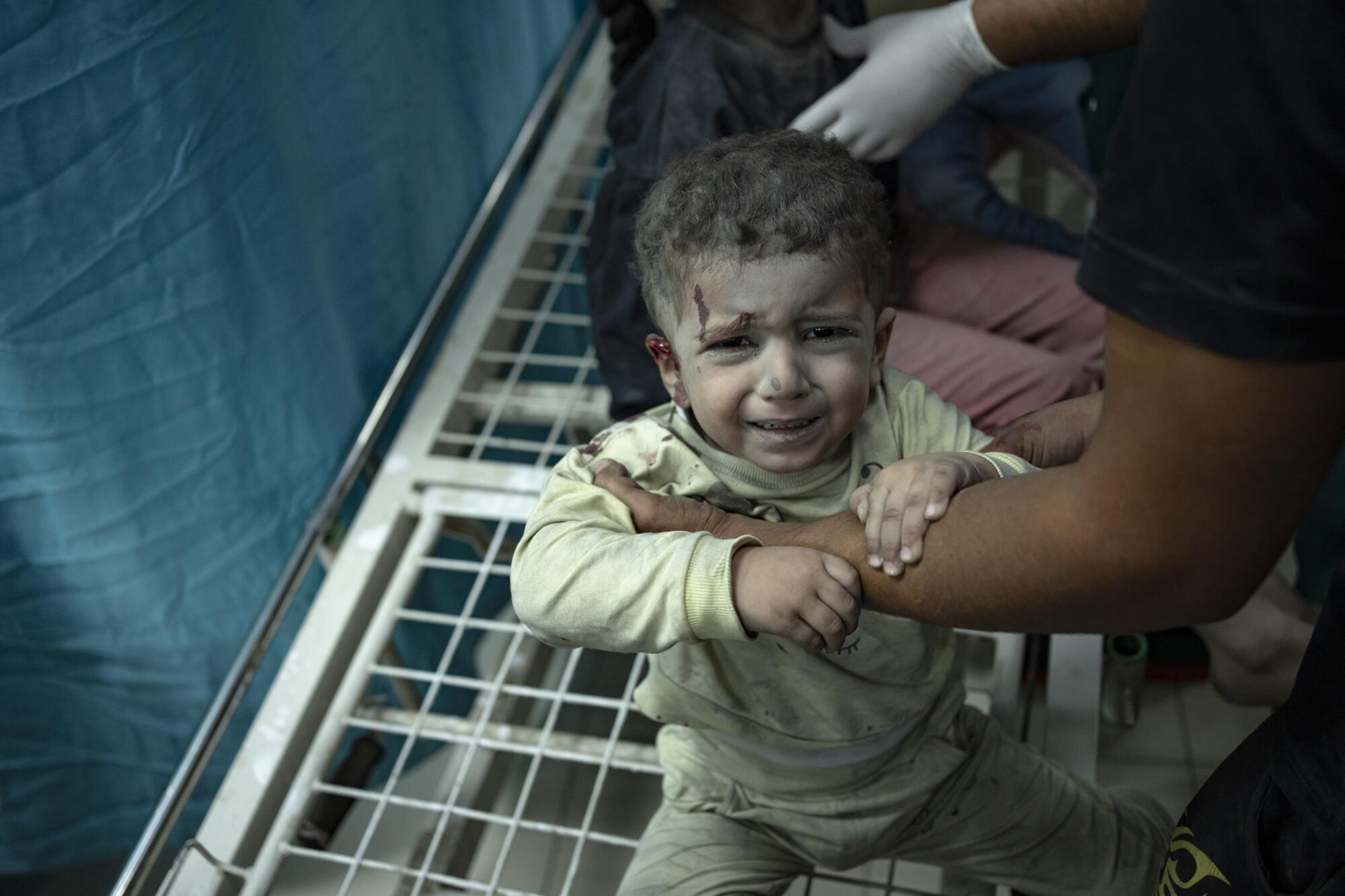 Wounded young child crying, with blood above one eye 
