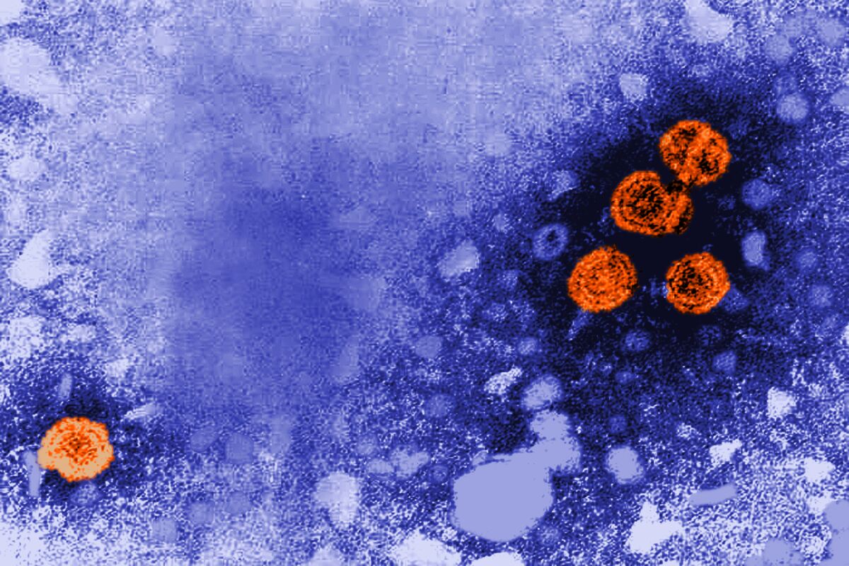 This 1981 electron microscope image made available by the U.S. Centers for Disease Control and Prevention shows hepatitis B virus particles, indicated in orange. The round virions, which measure 42nm in diameter, are known as Dane particles. On Wednesday, Nov. 3, 2021, a government advisory committee recommended that all U.S. adults younger than 60 be vaccinated against hepatitis B, because progress against the liver-damaging disease has stalled. (Dr. Erskine Palmer/CDC via AP)