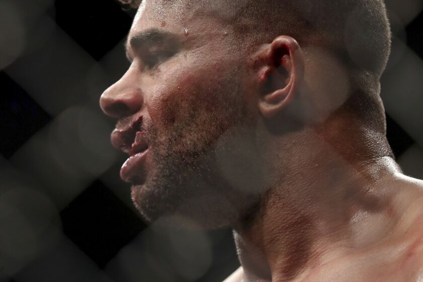 EDS NOTE-GRAPHIC CONTENT. Alistair Overeem is seen with a cut lip after being TKOd by Jairzinho Rozenstruik in their heavyweight mixed martial arts bout at UFC Fight Night, Sunday, December 8, 2019, in Washington, D.C. Rozenstruik won via 5th round TKO. (AP Photo/Gregory Payan)