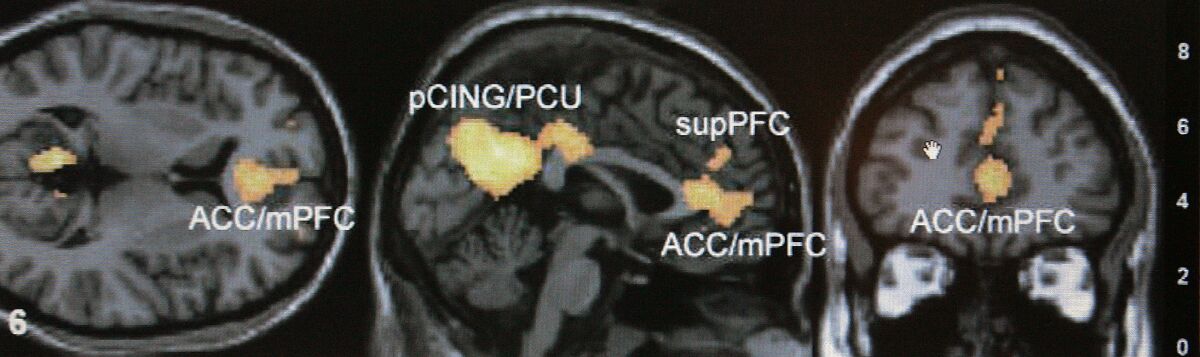 brain fmri scan