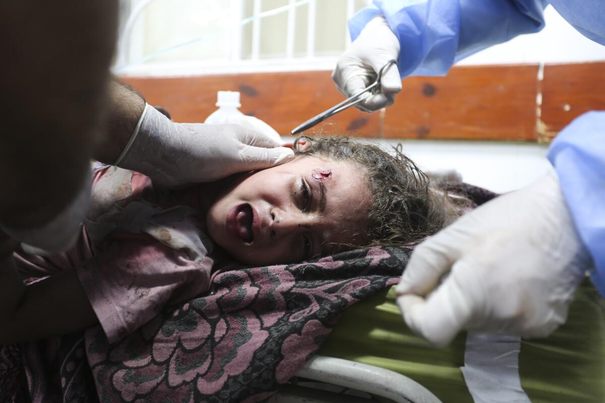 Una niña palestina herida en un ataque israelí sobre la Franja de Gaza recibe tratamiento