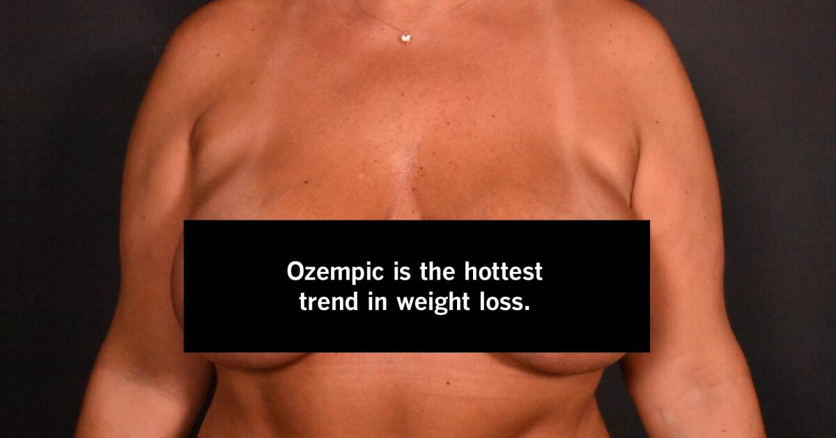 To fix Ozempic face (and Ozempic boobs), weight-loss patients are