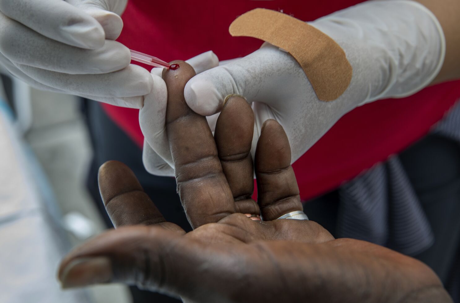 L.A. County sees spiking number of babies with syphilis - Los Angeles Times