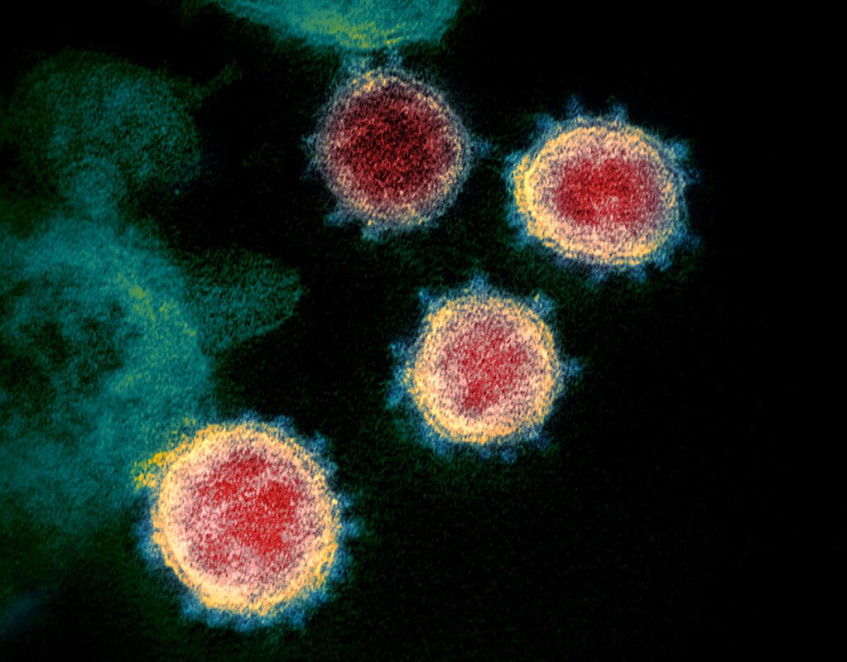 ARCHIVO - La imagen de microscopio muestra el virus causante del COVID-19.