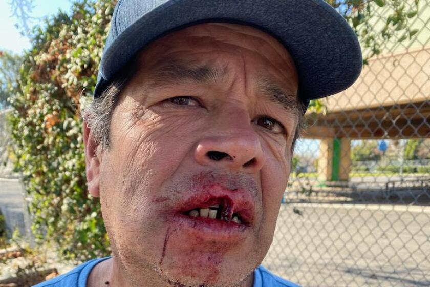 El costarricense Minor Bravo fue atacado por un hombre asiático en el vecindario Mid-City, en Los Ángeles.