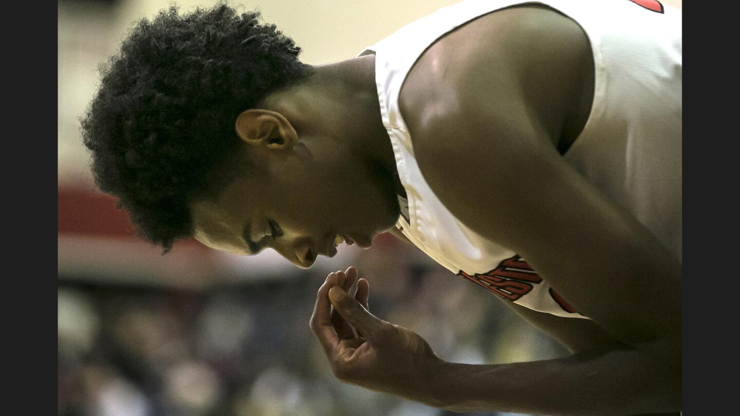 Westchester guard Jordan Brinson winces after his tooth was knocked out during first half action against Fairfax at Westchester High School.