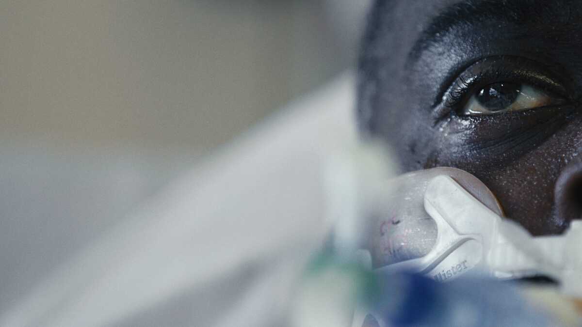 A closeup of a man's face, showing one eye and part of a ventilator.