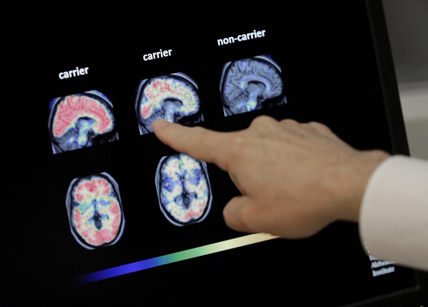 A doctor looks at brain scans