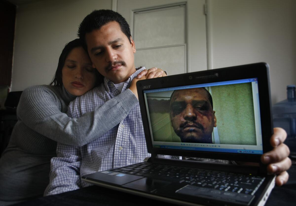 Gabriel Carrillo and Grace Martinez show a photo she took of Carrillo a few days after he was beaten by Los Angeles County sheriff's deputies at the Men's Central Jail.