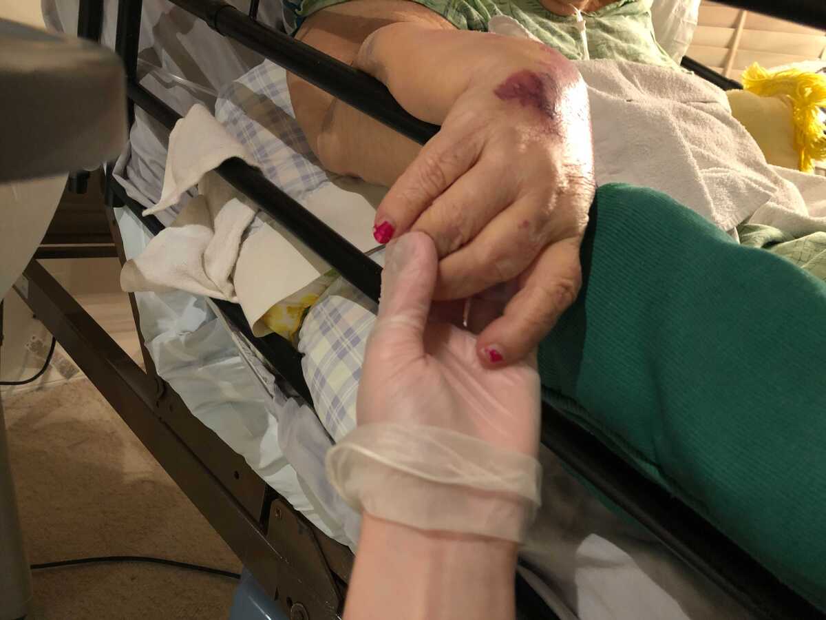 A granddaughter, wearing a glove, holds the hand of her grandmother in hospice