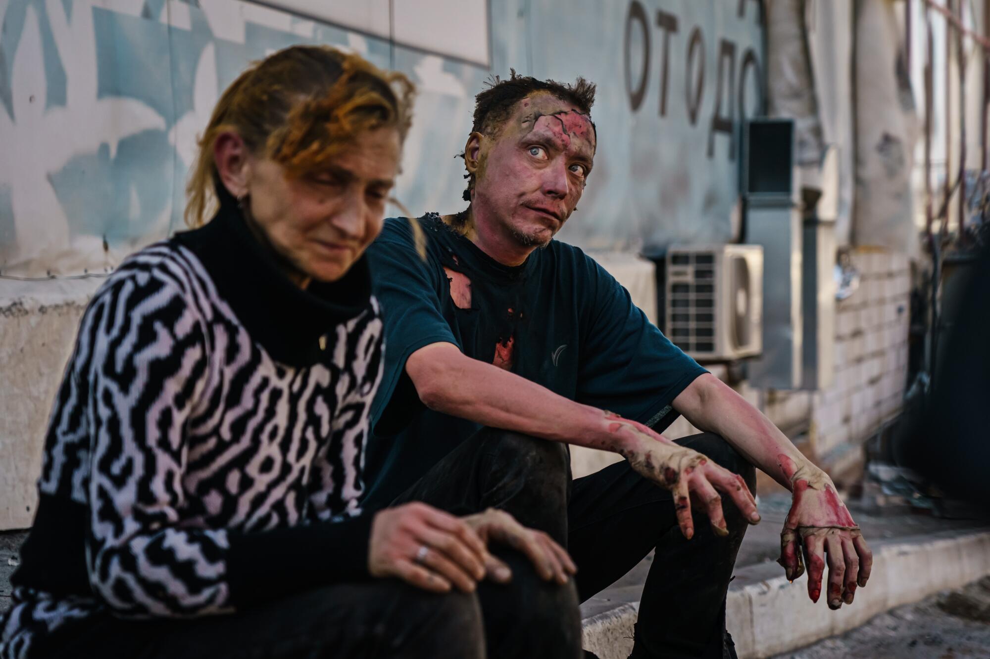 A woman on left and a man sit on a sidewalk curb. The man has burn injuries on his face, body and hands.