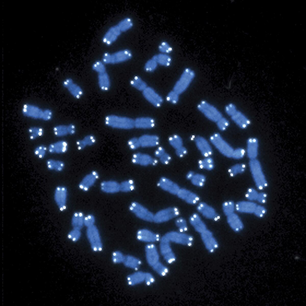 This microscope image shows the 46 human chromosomes. New research offers some of the first biological clues to why women may be more likely than men to develop Alzheimer's disease.
