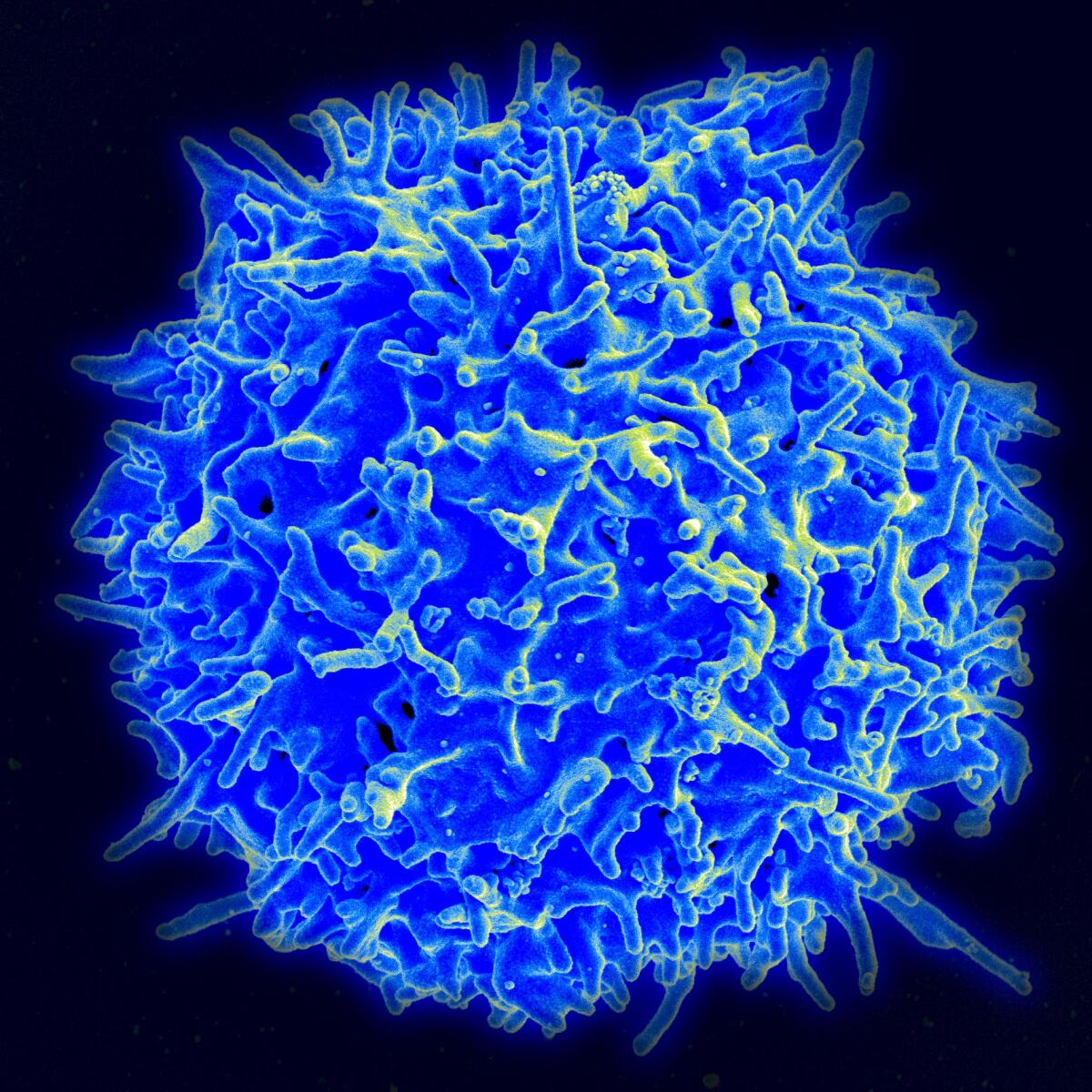 A scanning electron micrograph of a health human T cell.
