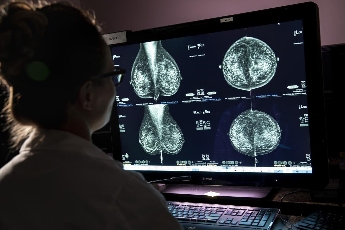 A doctor reviews a mammogram at UCLA in Westwood in May 2021.