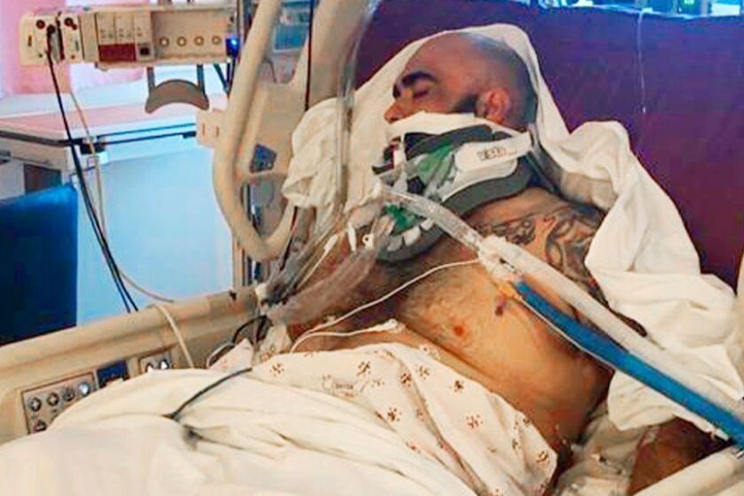 This undated photo provided by the Reyna family shows Rafael Reyna in his hospital bed at Los Angeles County-USC Medical Center in Los Angeles, after his beating outside Dodger Stadium. Bryan Stow, a San Francisco Giants fan who was left disabled in an attack outside Dodger Stadium that drew national attention eight years ago, said he's dismayed that Los Angeles police are again investigating an assault at the baseball stadium that left a man seriously injured. Authorities searched Monday, April 1, 2019, for a man who punched Rafael Reyna during an argument following Friday night's game. Christel Reyna says her husband Rafael sustained a skull fracture and is on life support.(Courtesy Reyna Family via AP)