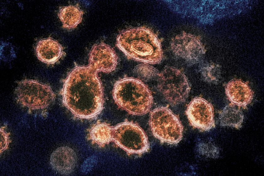 An image of SARS-CoV-2 coronavirus particles as seen under an electron microscope.