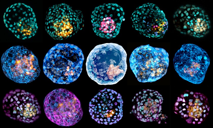 Microscope images of artificial, embryo-like structures called iBlastoids