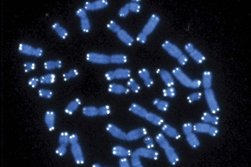 Esta imagen de microscopio muestra los 46 cromosomas humanos. Una nueva investigación ofrece algunas de las primeras pistas biológicas de por qué las mujeres pueden ser más propensas que los hombres a desarrollar la enfermedad de Alzheimer.