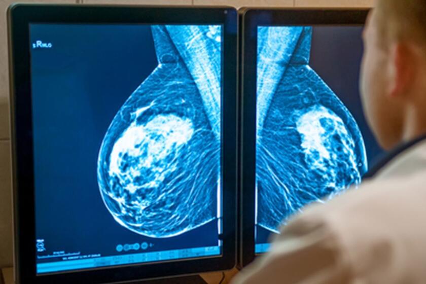 In Chicago, black women are more likely than white women to be diagnosed with breast cancer when the disease is at a late stage, making it more difficult to treat. (Dreamstime) ** OUTS - ELSENT, FPG, TCN - OUTS **