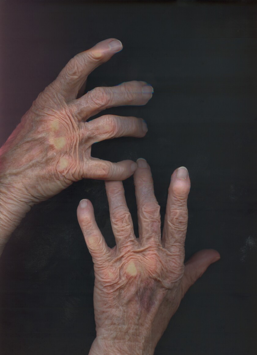 A pair of women's hands — bearing age spots and traces of arthritis — are seen against a black background.