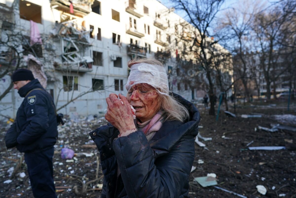 A woman with a bandaged head and bloodied face stands next to a badly damaged building