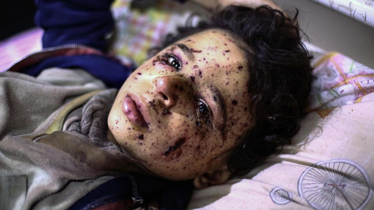 Omar, 10, receives treatment at a makeshift hospital Sunday after an airstrike that killed several members of his family.