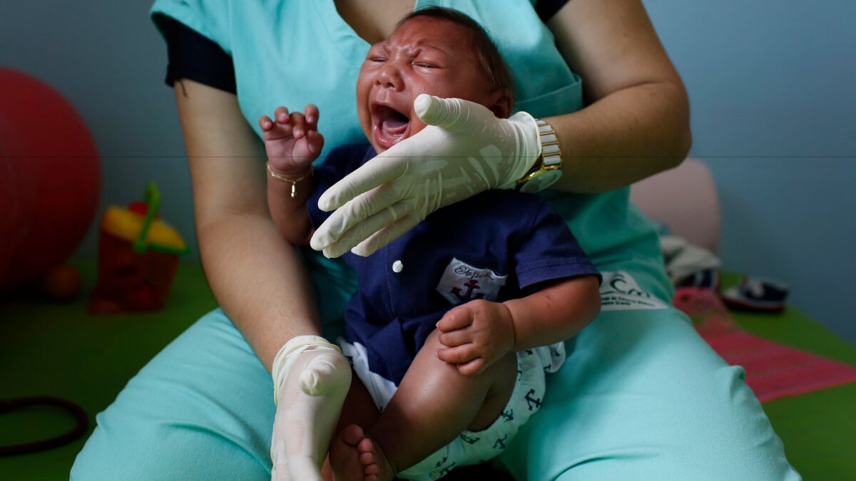 A baby born with with microcephaly cries during a physiotherapy session at the Pedro I Municipal Hospital in Campina Grande, Brazil.
