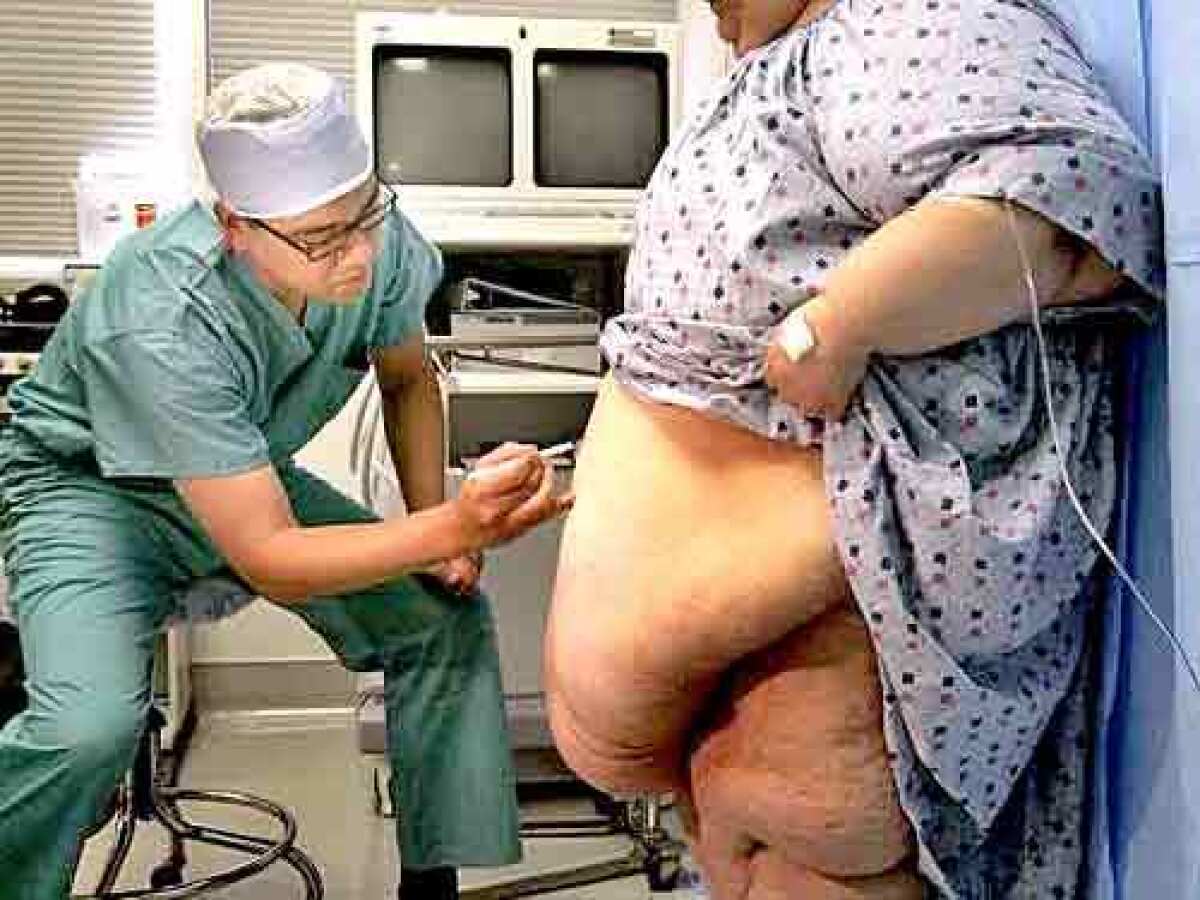 Just before surgery, Dr. Carson Liu outlines the folds of skin to be removed from Sheila Tehranis 5-foot, 2-inch frame.