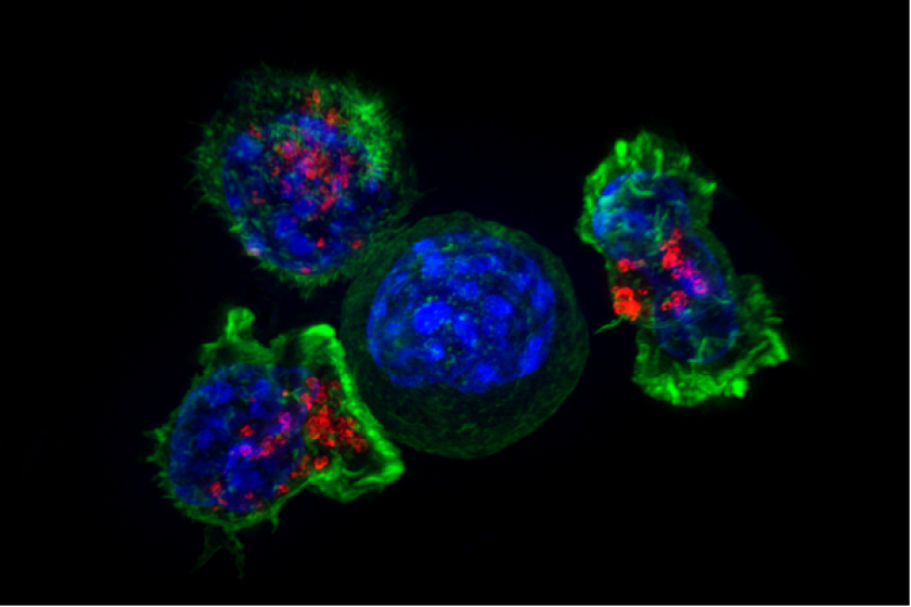  Killer T cells surround a cancer cell.
