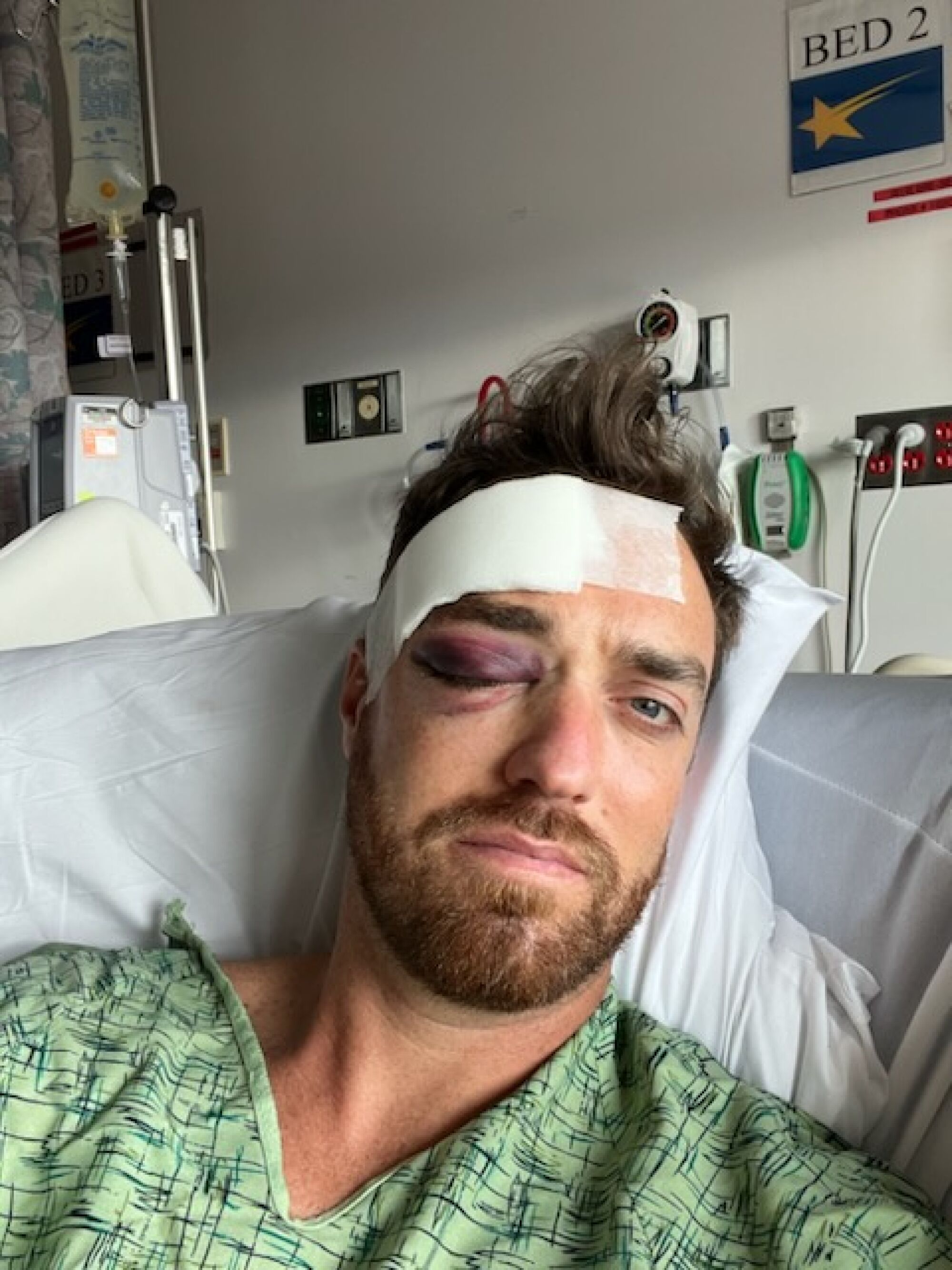 Nathan Crowley with facial injuries in a hospital bed.
