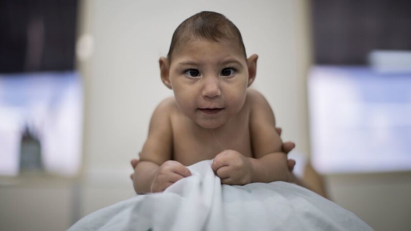 A baby girl born with microcephaly balances on a ball during a physical therapy session. New research from the Centers for Disease Control and Prevention finds that Zika infection during pregnancy increases the risk of birth defects by a factor of 20.