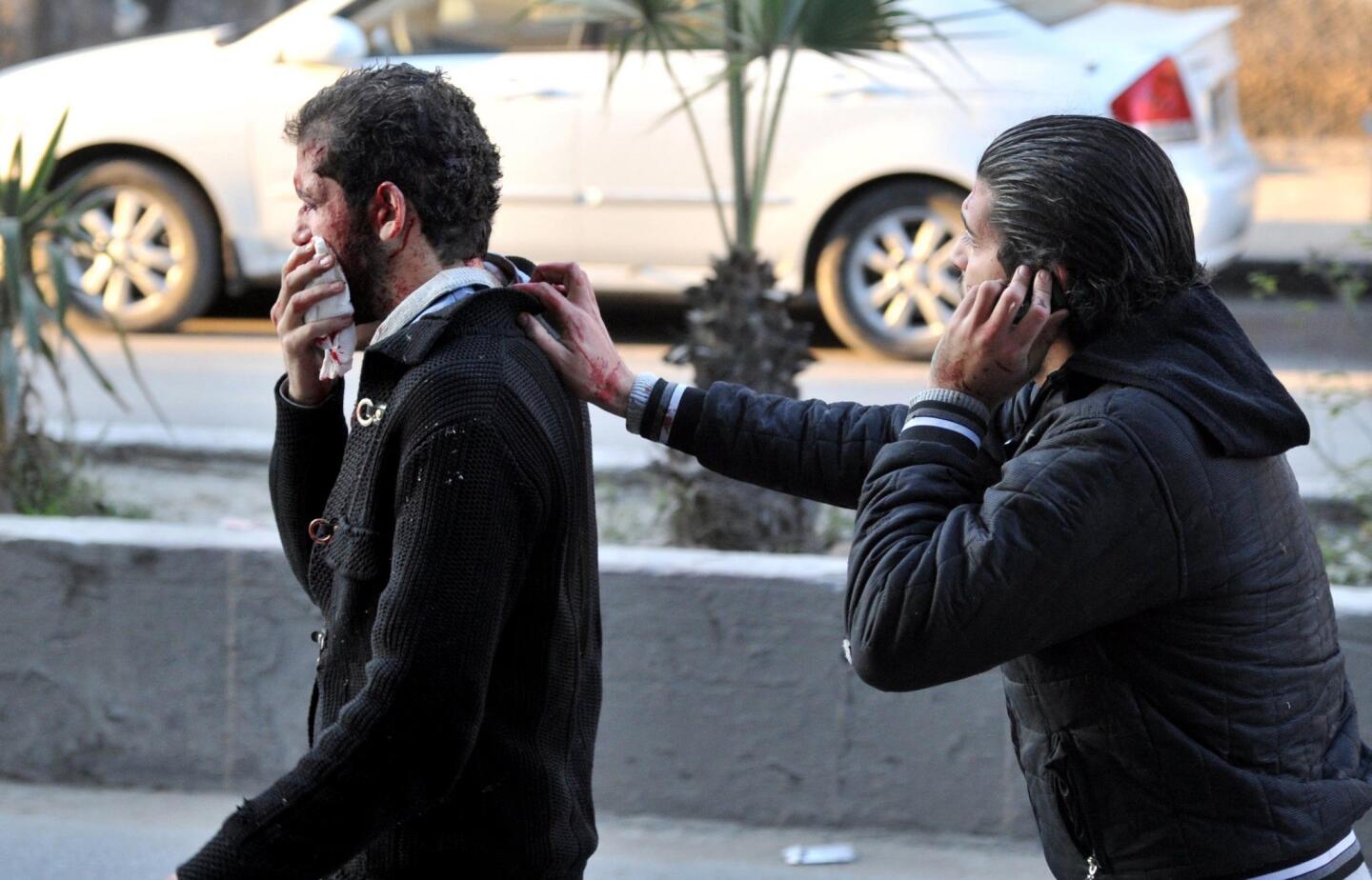 Two injured Syrian men near the scene of a car bomb explosion in Jaramana, a mainly Christian and Druze suburb of Damascus.