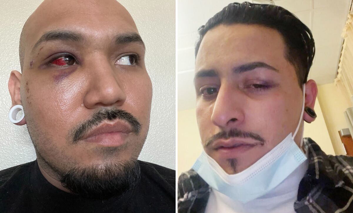 Photos of two men with facial injuries.