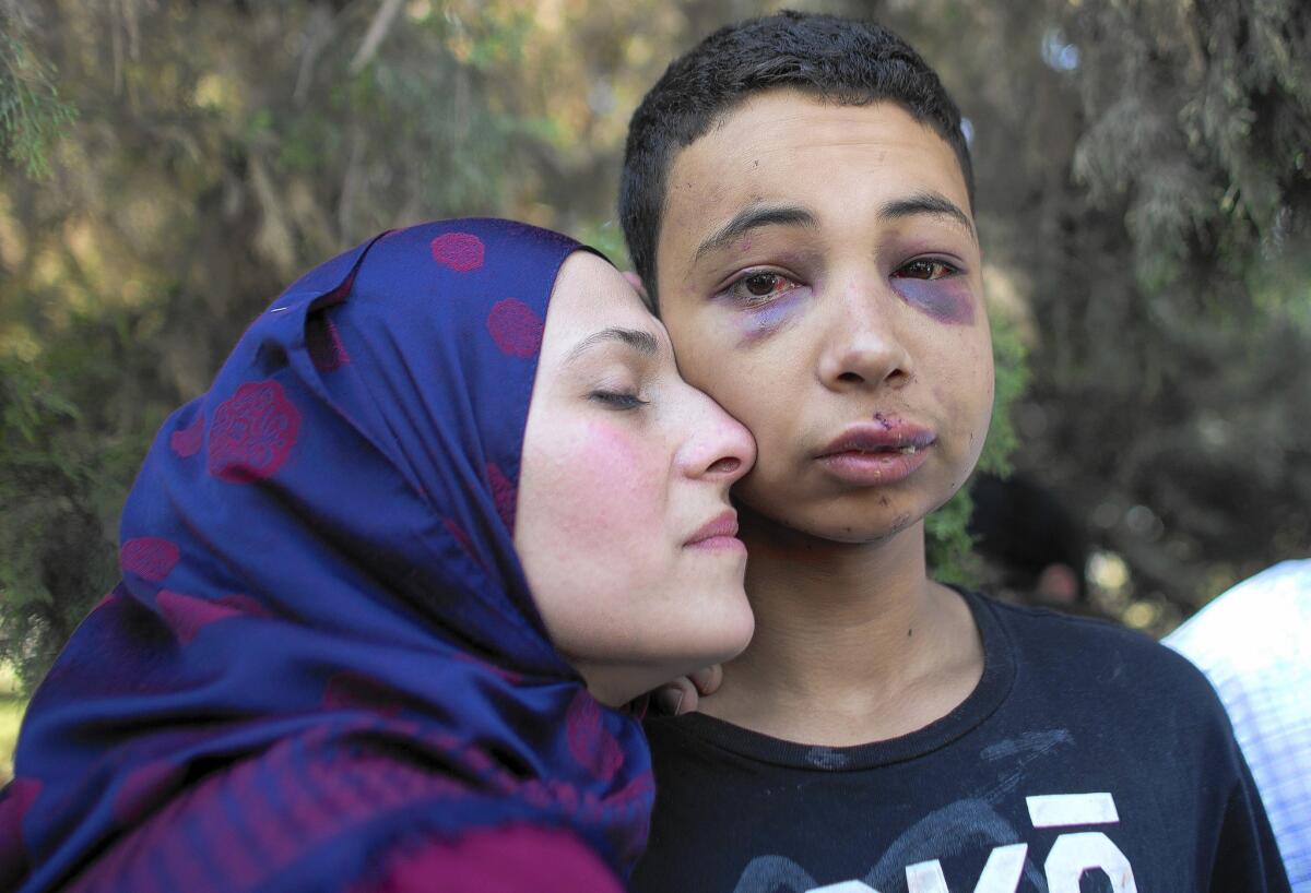 American Tariq Abukhdeir was released from custody amid condemnation of his beating, allegedly by Israeli police during protests Thursday. The 15-year-old, pictured with his mother, is the cousin of the Palestinian teen whose burned body was found in Jerusalem.