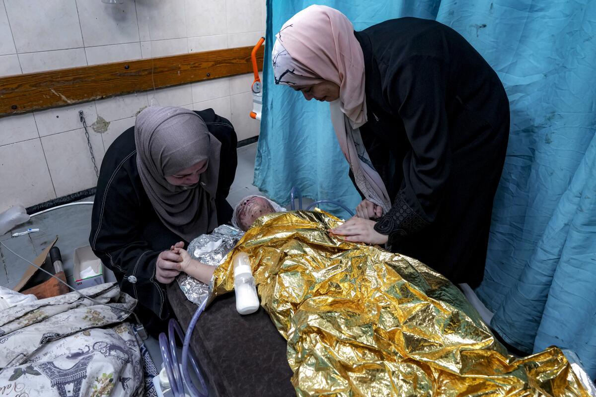 Two women look into the face of a wounded toddler on a gurney in a hospital.