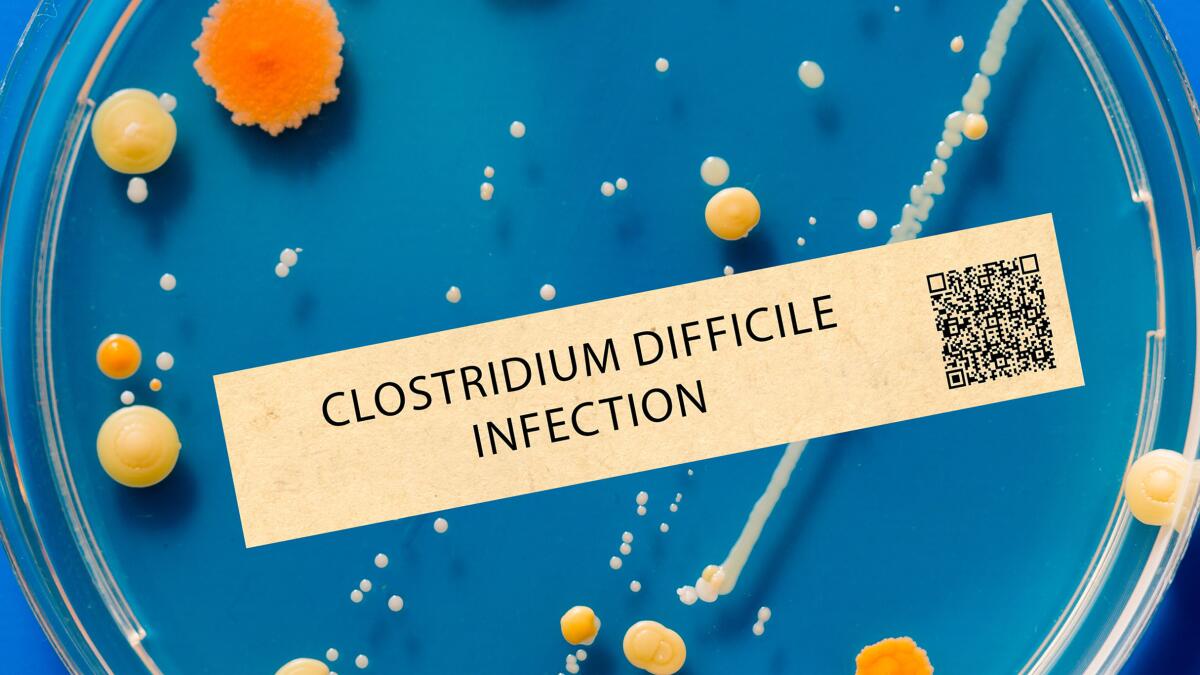 Clostridium difficile infection - Bacterial infection that can cause severe diarrhea and inflammation of the colon.