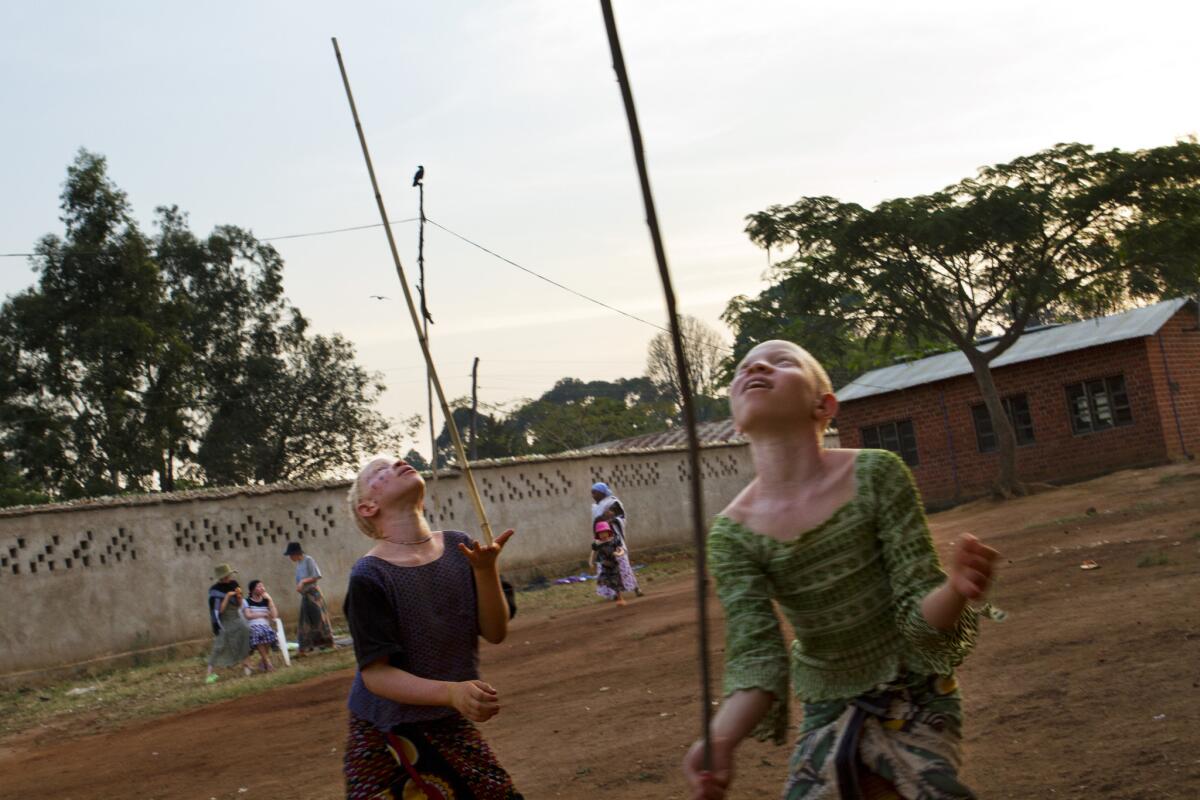 Zawia Kassim, 12, left, balances a pole on her hand with a friend at the Kabanga Protectorate Center in Kabanga, Tanzania in 2012. Having albinism, a genetic condition characterized by a lack of pigment in the body, puts them in danger in Tanzania.